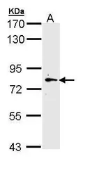 Anti-MYLK2 antibody [N3C3-2] used in Western Blot (WB). GTX111514
