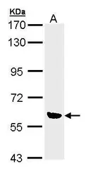 Anti-OXSR1 antibody [N1C1] used in Western Blot (WB). GTX111522