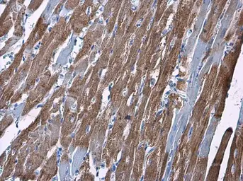 Anti-Hexokinase II antibody used in IHC (Paraffin sections) (IHC-P). GTX111525