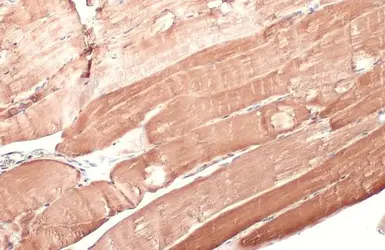 Anti-Hexokinase II antibody used in IHC (Paraffin sections) (IHC-P). GTX111525