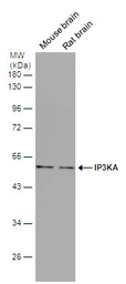 Anti-IP3KA antibody [N2C3] used in Western Blot (WB). GTX111539