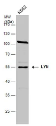 Anti-LYN antibody [N2C3] used in Western Blot (WB). GTX111543