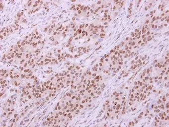 Anti-LYN antibody [N2C3] used in IHC (Paraffin sections) (IHC-P). GTX111543