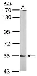 Anti-LYN antibody [N2C3] used in Western Blot (WB). GTX111543