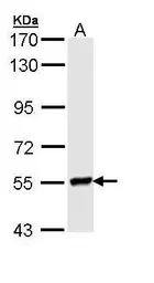 Anti-LYN antibody [N2C3] used in Western Blot (WB). GTX111543