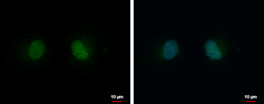Anti-PSKH2 antibody used in Immunocytochemistry/ Immunofluorescence (ICC/IF). GTX111548