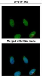 Anti-FAF1 antibody [C1C3] used in Immunocytochemistry/ Immunofluorescence (ICC/IF). GTX111553