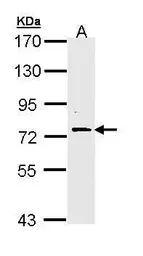 Anti-FAF1 antibody [C1C3] used in Western Blot (WB). GTX111553