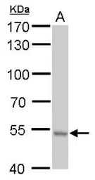 Anti-RNPEPL1 antibody used in Western Blot (WB). GTX111563