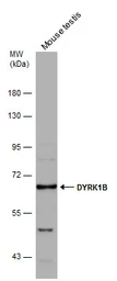 Anti-DYRK1B antibody used in Western Blot (WB). GTX111575