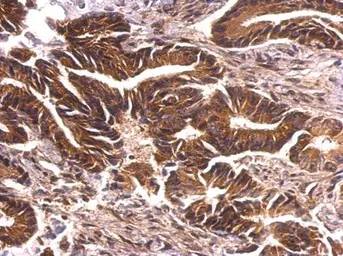 Anti-PKN2 antibody [N1N3] used in IHC (Paraffin sections) (IHC-P). GTX111577