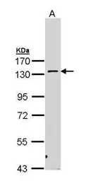 Anti-PKN2 antibody [N1N3] used in Western Blot (WB). GTX111577