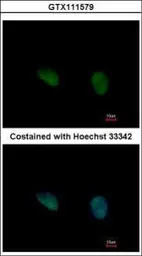 Anti-PHKG2 antibody [N2C3] used in Immunocytochemistry/ Immunofluorescence (ICC/IF). GTX111579