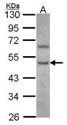 Anti-PHKG2 antibody [N2C3] used in Western Blot (WB). GTX111579