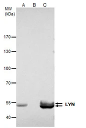Anti-LYN antibody used in Immunoprecipitation (IP). GTX111584