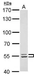 Anti-LYN antibody used in Western Blot (WB). GTX111584
