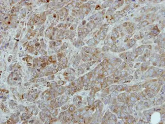 Anti-Raf1 antibody [N1C1-2] used in IHC (Paraffin sections) (IHC-P). GTX111588