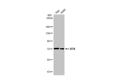 Anti-BTK antibody used in Western Blot (WB). GTX111592