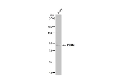 Anti-PFKM antibody [C1C3] used in Western Blot (WB). GTX111597