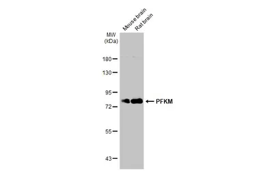 Anti-PFKM antibody [C1C3] used in Western Blot (WB). GTX111597