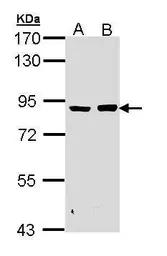 Anti-PFKM antibody [C1C3] used in Western Blot (WB). GTX111597