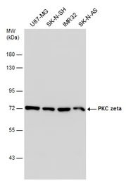 Anti-PKC zeta antibody used in Western Blot (WB). GTX111598