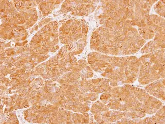 Anti-PKC zeta antibody used in IHC (Paraffin sections) (IHC-P). GTX111598