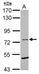 Anti-EphB6 antibody [C1C3] used in Western Blot (WB). GTX111601