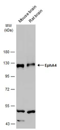 Anti-EphA4 antibody [N3C2-2], Internal used in Western Blot (WB). GTX111602