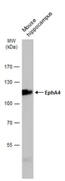 Anti-EphA4 antibody [N3C2-2], Internal used in Western Blot (WB). GTX111602