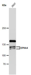 Anti-EphA4 antibody [N3C2-2], Internal used in Western Blot (WB). GTX111602