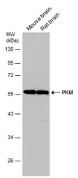 Anti-PKM antibody used in Western Blot (WB). GTX111604