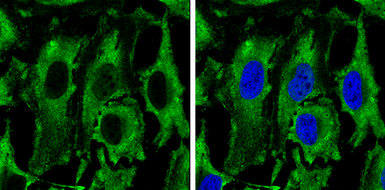 Anti-PKM antibody used in Immunocytochemistry/ Immunofluorescence (ICC/IF). GTX111604