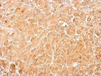 Anti-PKM antibody used in IHC (Paraffin sections) (IHC-P). GTX111604