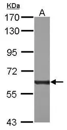 Anti-PKM antibody used in Western Blot (WB). GTX111604