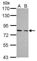 Anti-cGK1 antibody used in Western Blot (WB). GTX111610