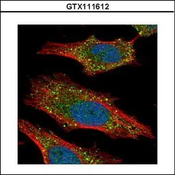 Anti-AKT2 antibody used in Immunocytochemistry/ Immunofluorescence (ICC/IF). GTX111612