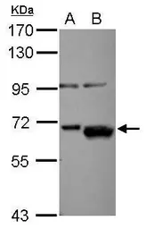 Anti-AKT2 antibody used in Western Blot (WB). GTX111612