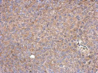 Anti-HISPPD1 antibody [N1N2], N-term used in IHC (Paraffin sections) (IHC-P). GTX111614