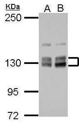 Anti-HISPPD1 antibody [N1N2], N-term used in Western Blot (WB). GTX111614