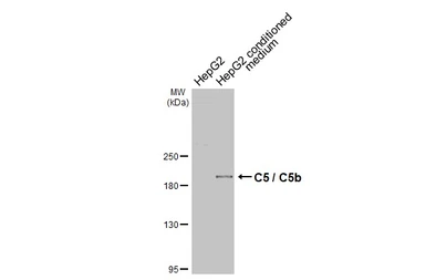 Anti-C5 / C5b antibody [C2C3-2], C-term used in Western Blot (WB). GTX111625