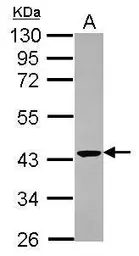 Anti-CNPase antibody [N2C3-2] used in Western Blot (WB). GTX111641