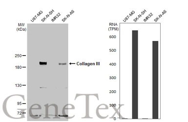 Anti-Collagen III antibody [C2C3-2], C-term used in Western Blot (WB). GTX111643