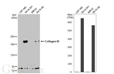 Anti-Collagen III antibody [C2C3-2], C-term used in Western Blot (WB). GTX111643