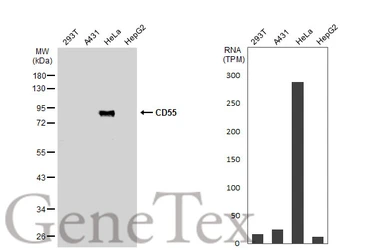 Anti-CD55 antibody [N2C3-2] used in Western Blot (WB). GTX111647
