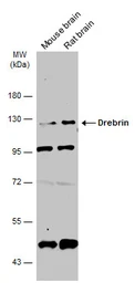 Anti-Drebrin antibody used in Western Blot (WB). GTX111649