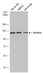 Anti-Drebrin antibody used in Western Blot (WB). GTX111649