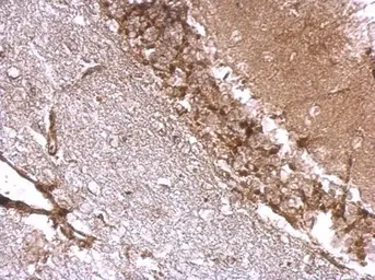 Anti-Drebrin antibody used in IHC (Paraffin sections) (IHC-P). GTX111649