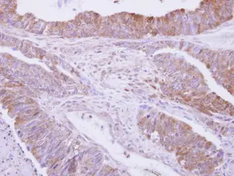 Anti-Drebrin antibody used in IHC (Paraffin sections) (IHC-P). GTX111649