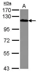 Anti-Drebrin antibody used in Western Blot (WB). GTX111649